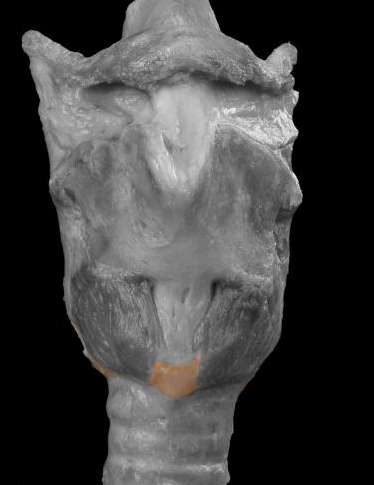 <p>What is this Cartilage</p>