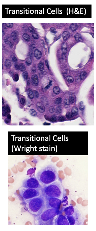 <p>What color does the nuclei appear to be with a Romanovsky stain (e.g. Wright Stain, DifQuik)?</p>