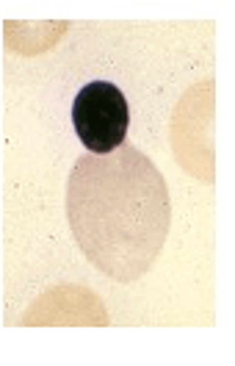 <p>What stage of erythropoiesis is observed?</p>