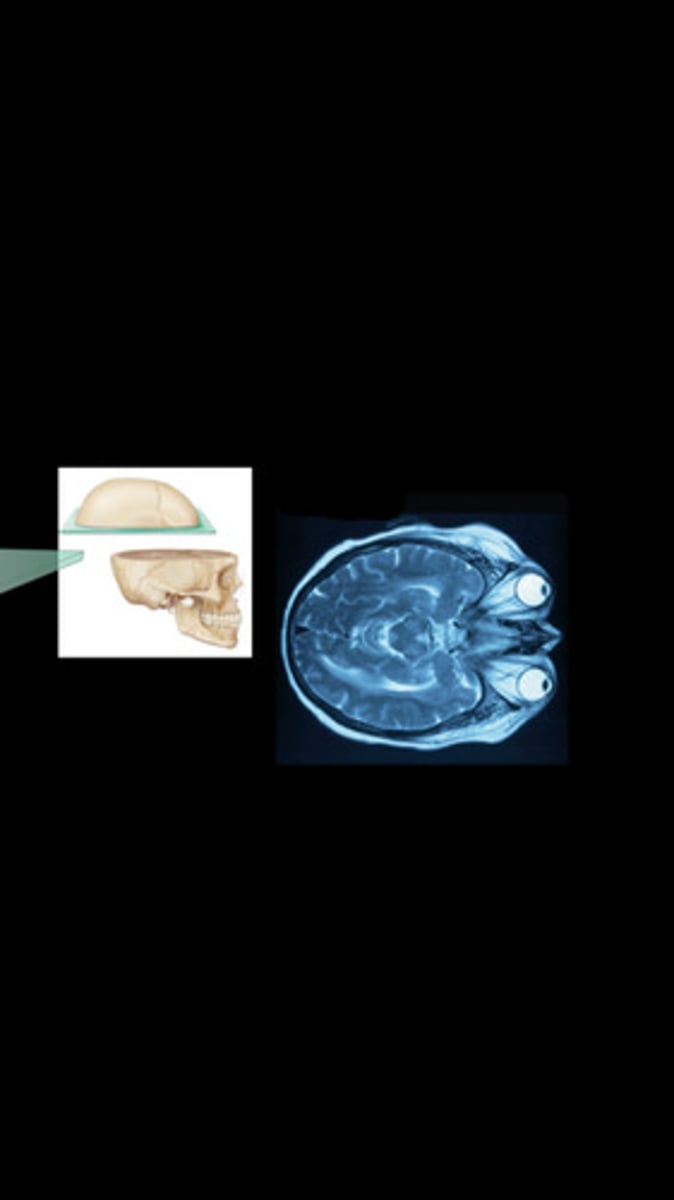 <p>Divides body or organ into superior and inferior parts (top and bottom)</p>