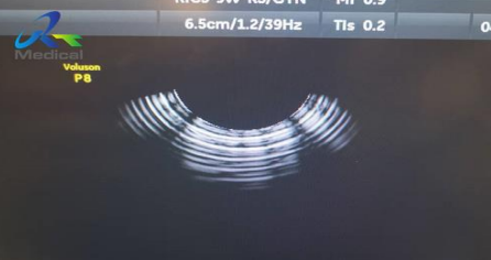 <p>what type of artifact is this?</p>