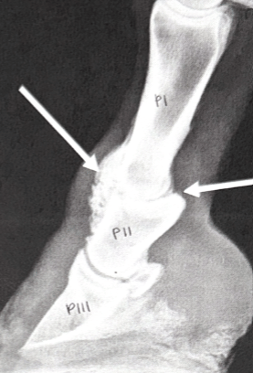 <p>What is the layperson's term for the joint indicated by the arrows?</p>