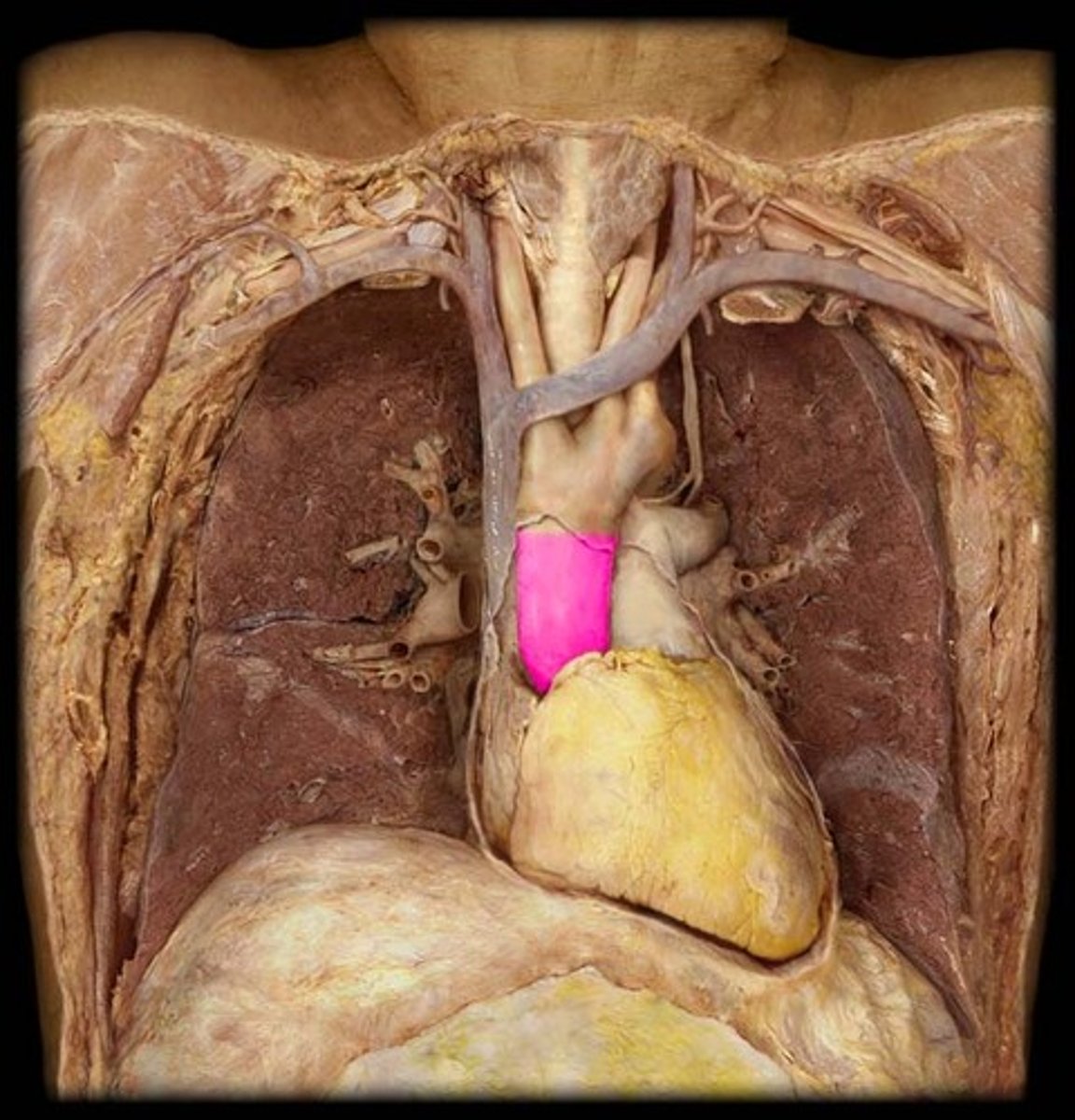 <p>The portion of the aorta that rises from the left ventricle and carries oxygenated blood to the body.</p>