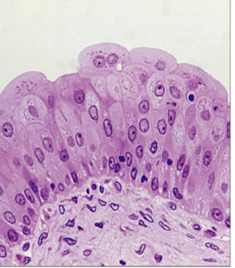 <p>Stratified cells with irregular shapes. Function is to accommodate fluctuations in volume of fluid. The can be found in the urinary bladder.</p>