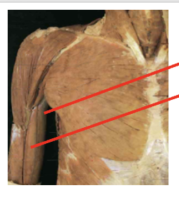 <p>What muscle is this? What is its origin. Where does it inserts. </p>