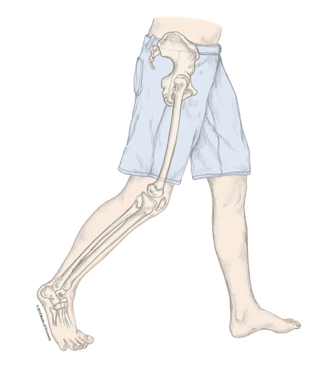 <p>What stage of the stance phases is the R LE in?</p>