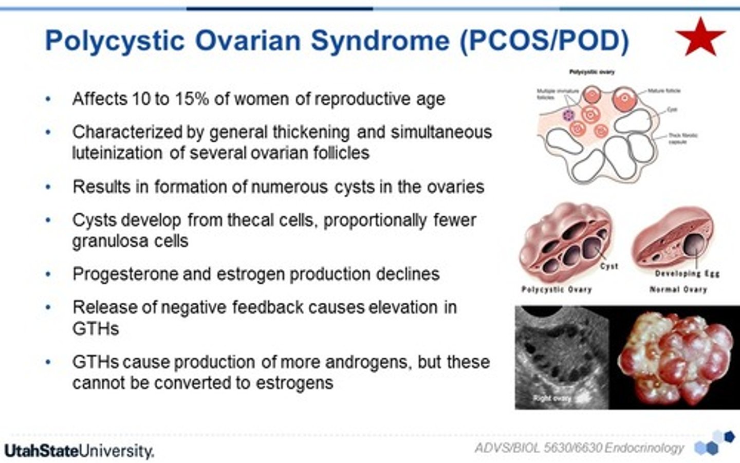 <p>endocrine disorder associated with chronic anovulation - caused by imbalance of reproductive hormones</p>