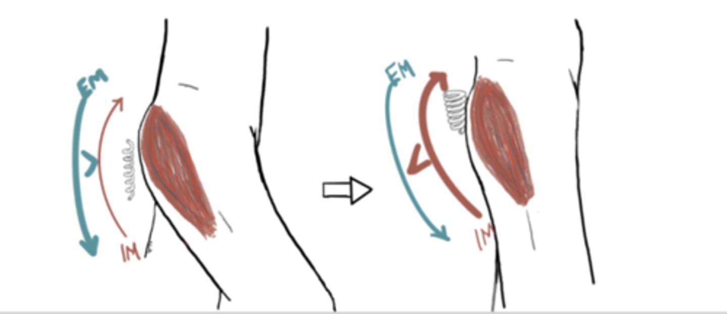 <p>1.</p><p>IM: Extension moment (glutes)</p><p>EM: Flexion Moment</p><p>IM<em (eccentric)="" angle="brief" 32°="" flexion="" 2.="" im:="" extension="" moment="" (glutes)="" em:="" im="">EM (concentric)</p><p>Angle = 30° flexion</em></p>