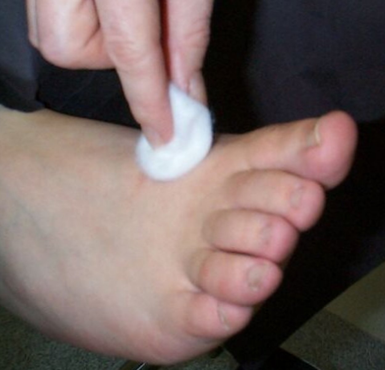 <p>-superficial skin receptors</p><p>-important for fine discriminatory hand use </p><p>-indicator of better sensation than having only deep touch pressure awareness</p><p>perceive touch through light pressure or use of a cotton ball</p><p>assessed with Semmes W. monofilaments</p>