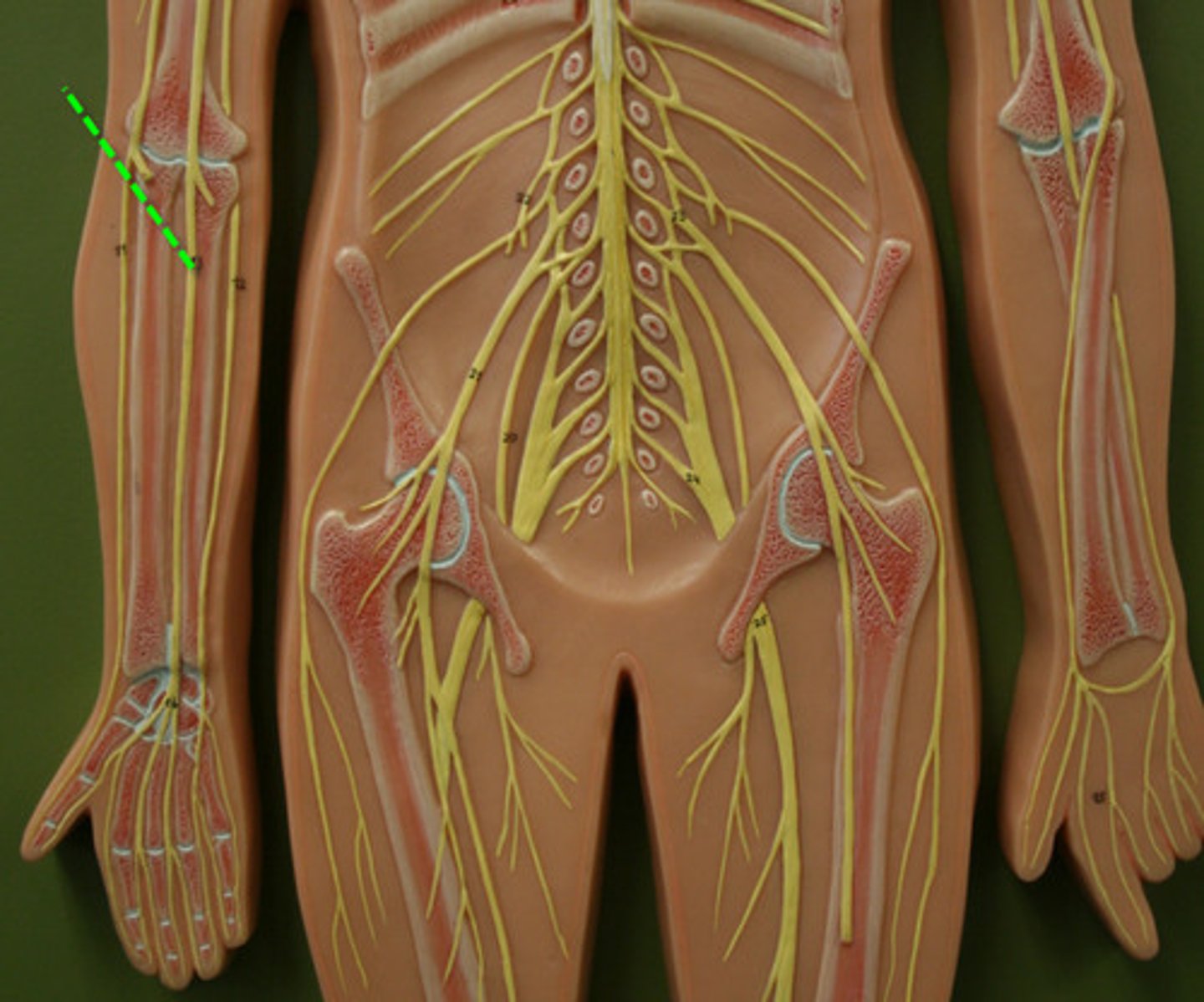<p>Mixed sensory & motor nerve (C6-T1)</p><p>Travels with the brachial artery</p><p>Gives off the anterior interosseous nerve below cubital fossa which supplies deep muscles of the flexor compartment.</p><p>Median nerve continues down the forearm and gives off the palmar cutaneous branch just before the wrist - which innervates thenar eminance.</p>