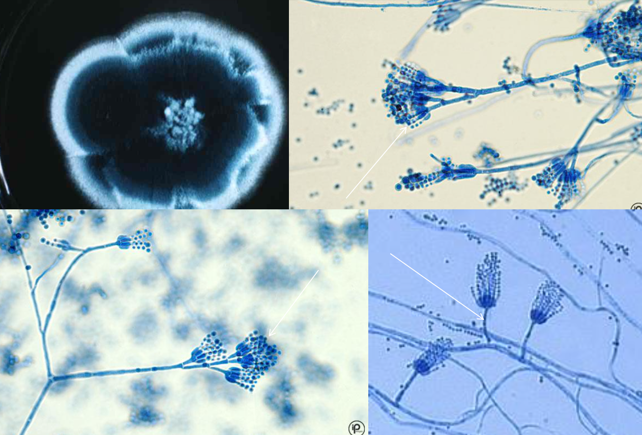 <p>Colony and microscopic morphology of: Penicillium</p>
