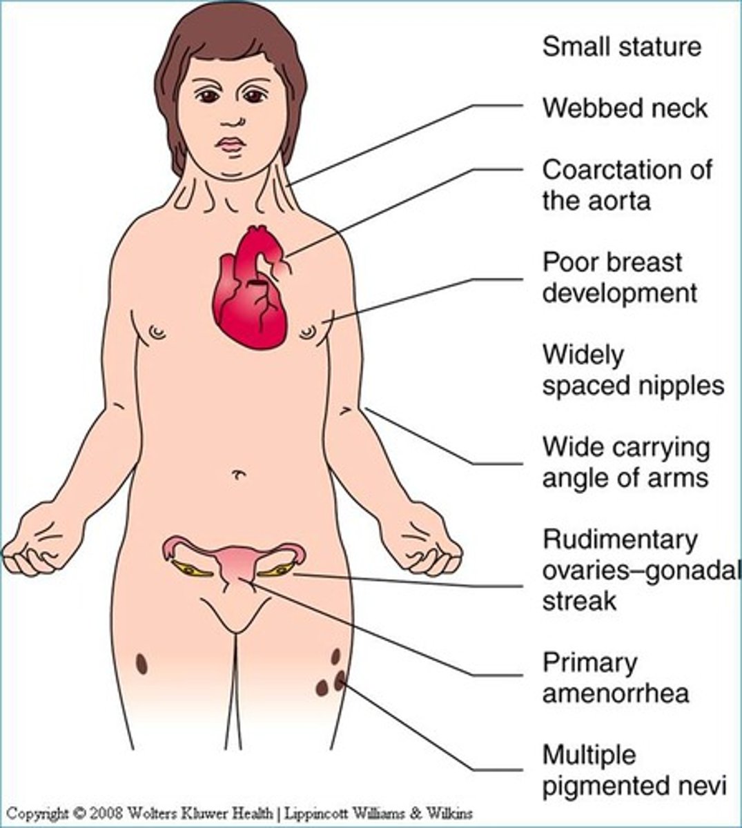 <p>- XO</p><p>- Ovaries</p><p>- Internal: Mullerian (no AMH or T)</p><p>- External: feminization (no DHT)</p>
