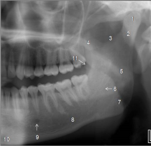 <p>Identify The Structures On The Mandible.</p>