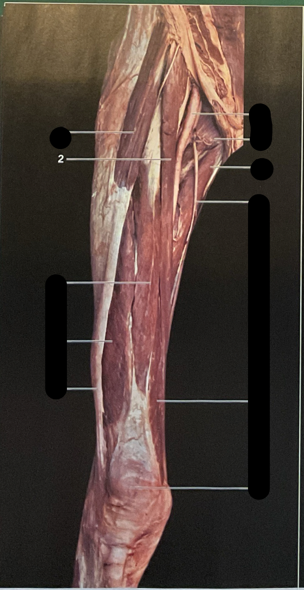 knowt flashcard image
