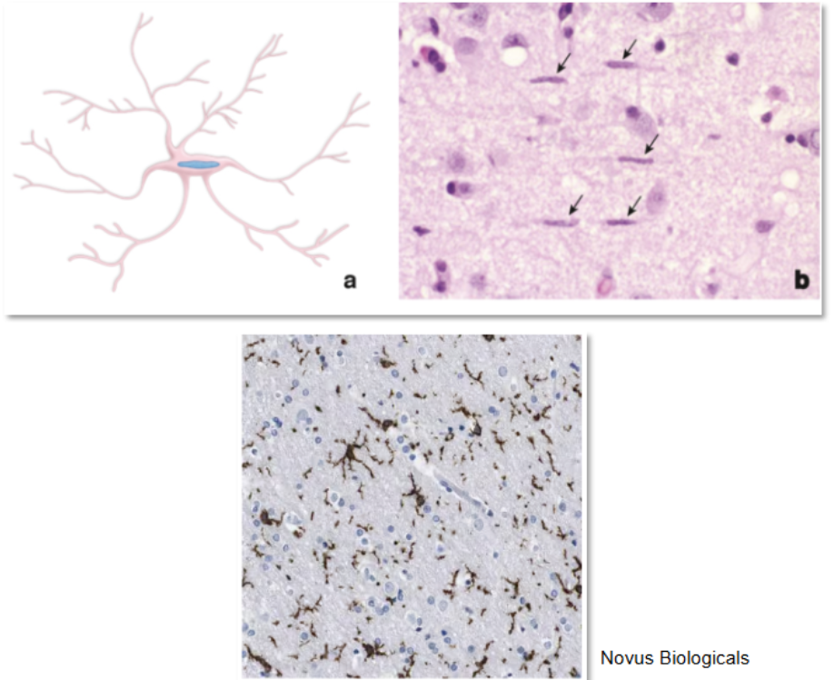 <p>phagocytic and antigen presenting functions that defend the CNS from infection by bacteria, viruses, and fungi </p>