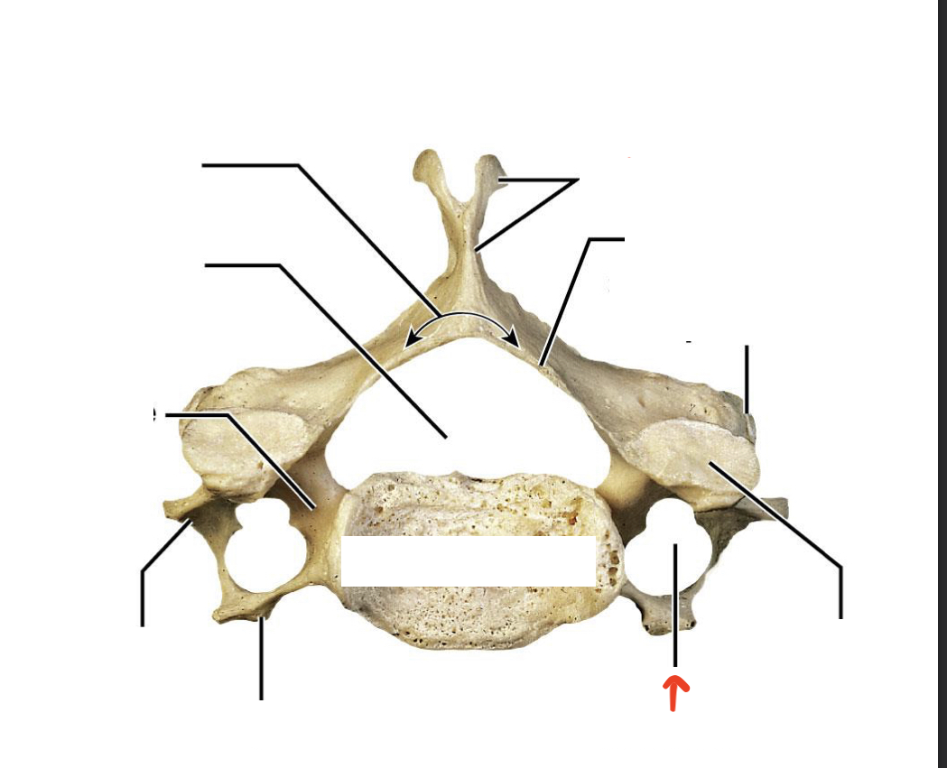 <p>hole in transverse process</p>