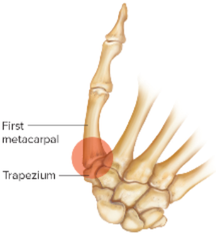 <p>What is this image an example of? </p>