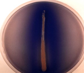 Enzyme that converts the Lipid Triglyceride substrate into the Glycerol and Fatty Acid monomers

\
Used by:


1. Bacillus Subtilis
2. Staphylococcus Aureus

\
Tested for using the Spirit Blue Agar media