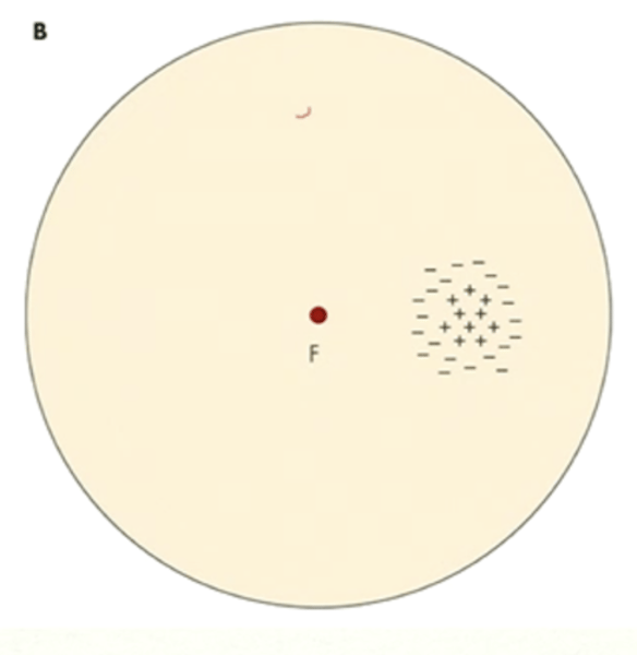 <p>Receptive field recordings can be determined by inserting a microelectrode into an anesthetized animal and directing the fovea of that animal to a point on a screen. Spots of light are directed onto various areas the screen. The microelectrode then records activity of a neuron on the retina.<br><br>When the spotlight is within a neuron's receptive field, what 2 things can happen?</p>