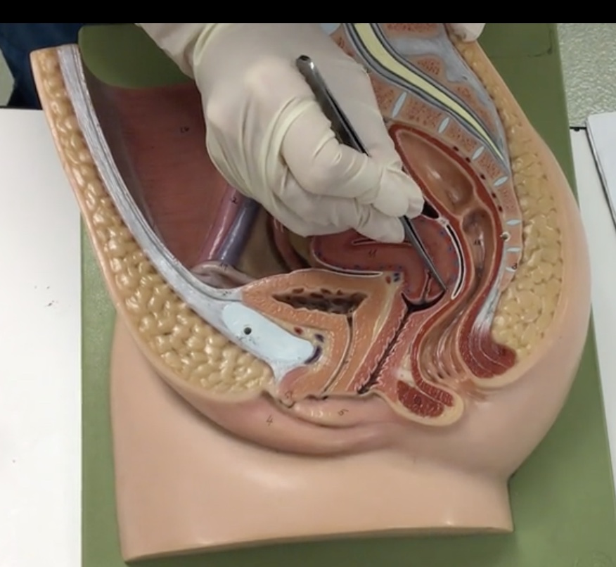 <p>Description: Recess surrounding cervix</p><p>Relationship: N/A</p>