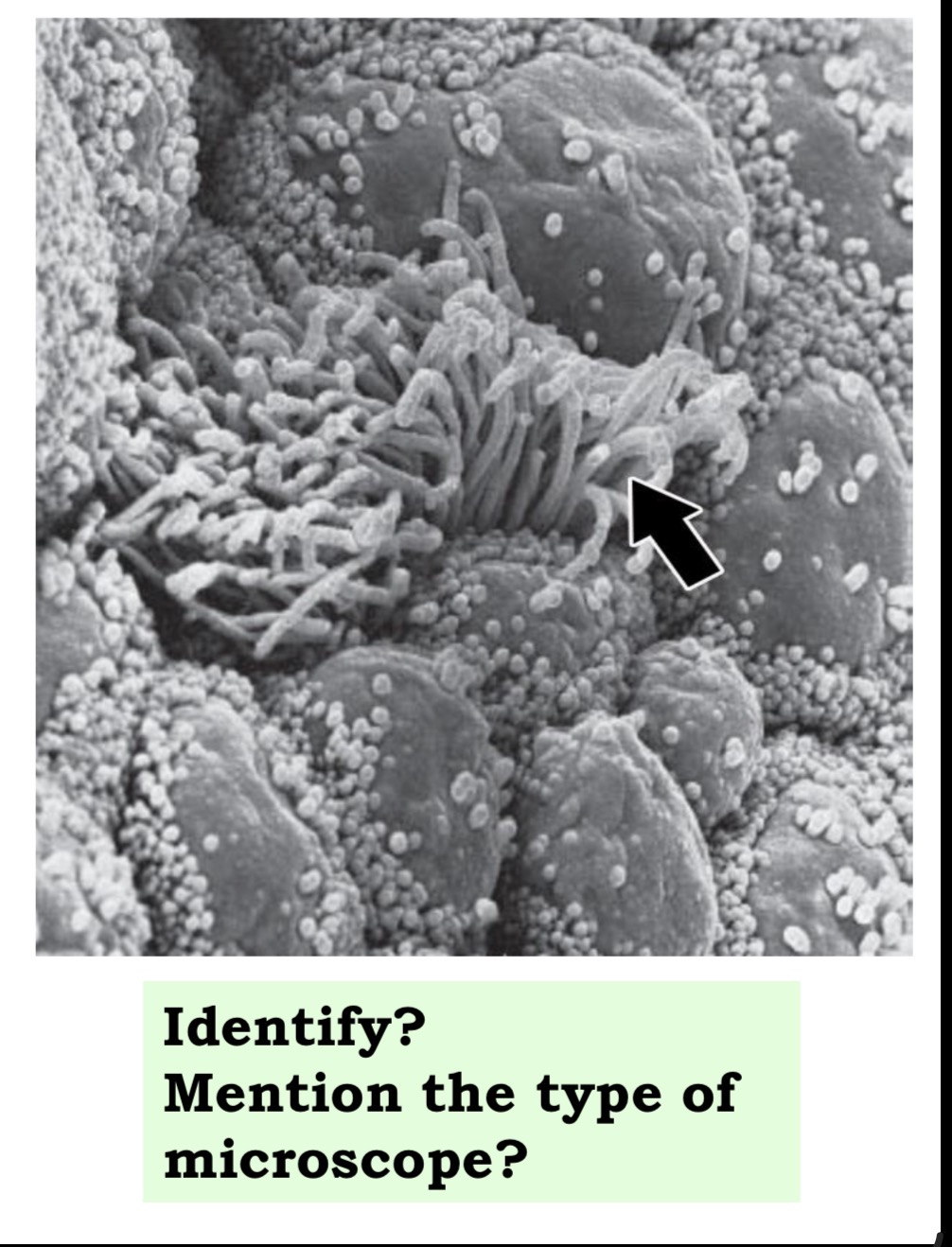 <p>Answer the questions in these following pictures </p>