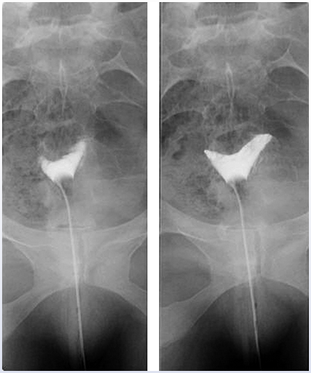 <p>difficulty conceiving. </p>