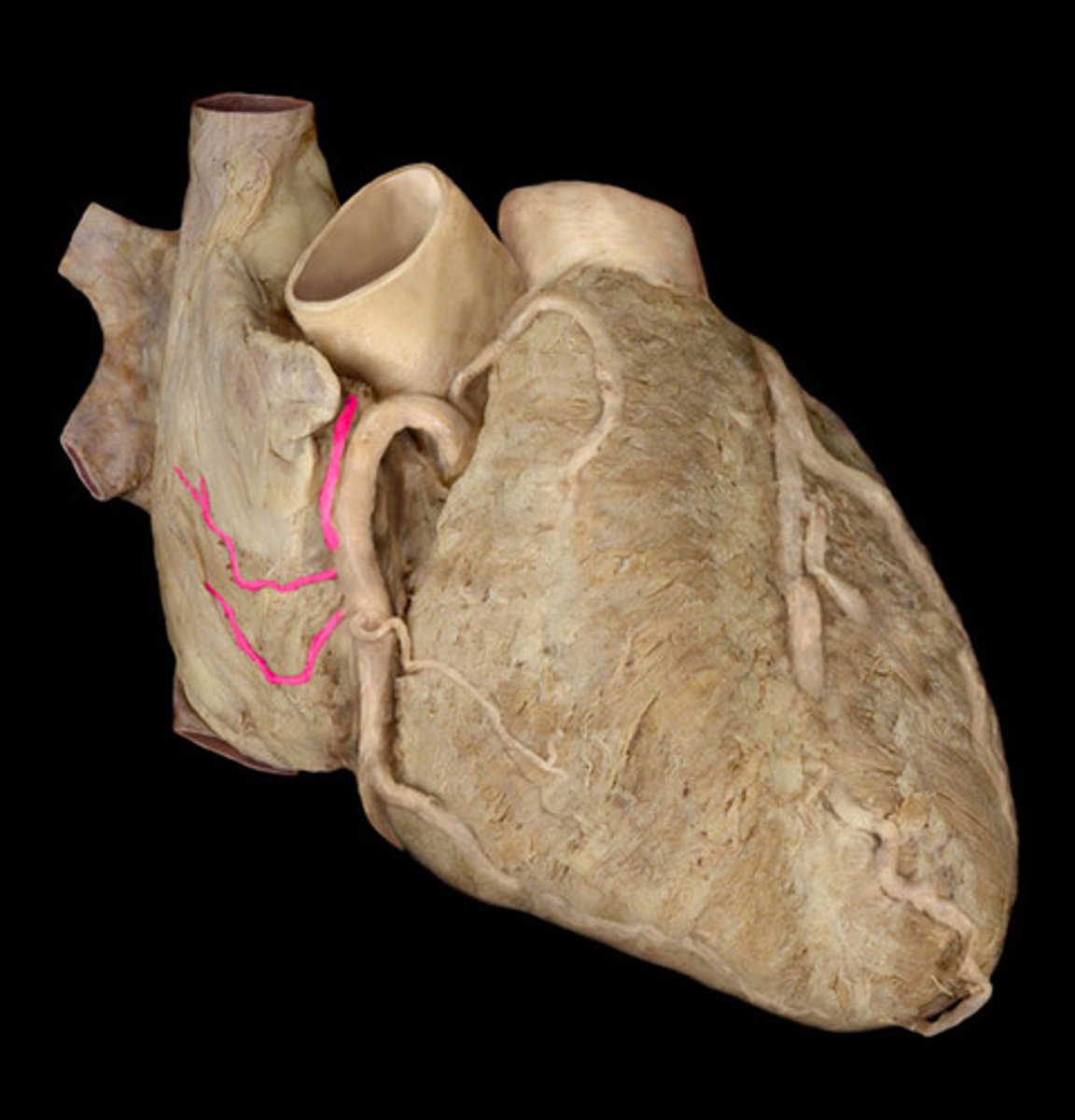 <p>right coronary artery branch</p>