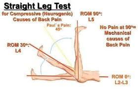 <p><span style="font-family: &quot;Bodoni MT&quot;">Straight leg test is better at ruling out a lumbar disc herniation with a sensitivity upwards of 92%.</span></p><p style="text-align: left"></p><p style="text-align: left"><span style="font-family: &quot;Bodoni MT&quot;">It has a poor specificity of ruling in a lumbar disc herniation.</span><span>&nbsp;</span></p>