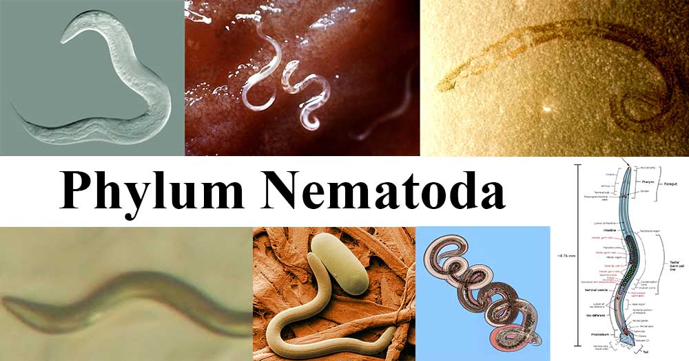 <p>Nematoda and Nematomorpha</p>