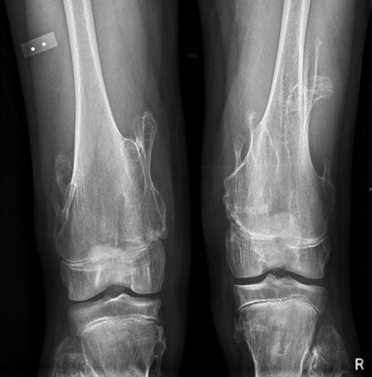 <p>Concerns/complications?</p>