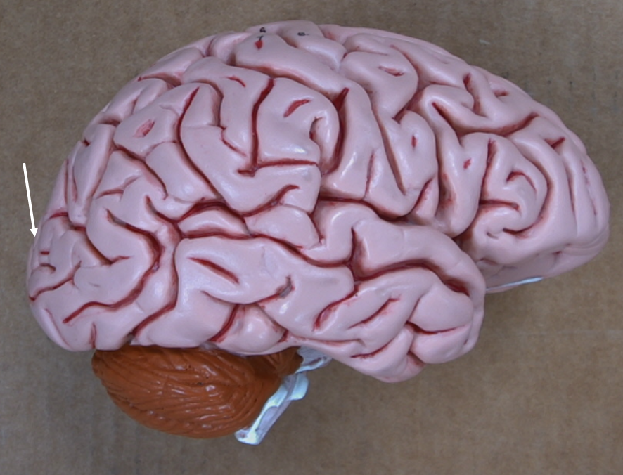 <p>occipital lobe</p>