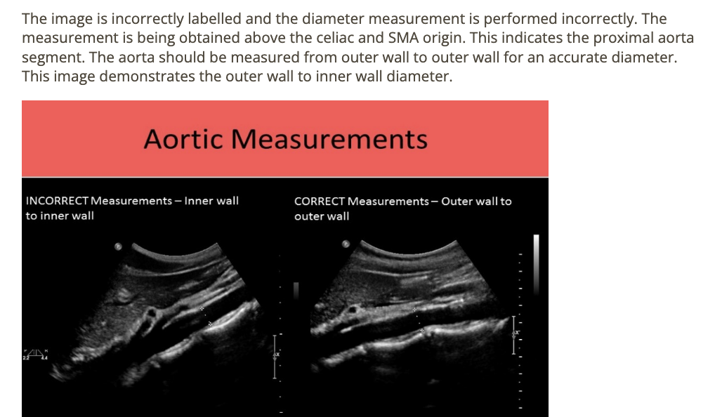 <p>a) incorrect label + diameter</p>