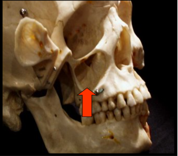 <p><span>Paired cavities or compartments of bone that are located within the maxilla, superior to the maxillary posterior teeth.</span></p>