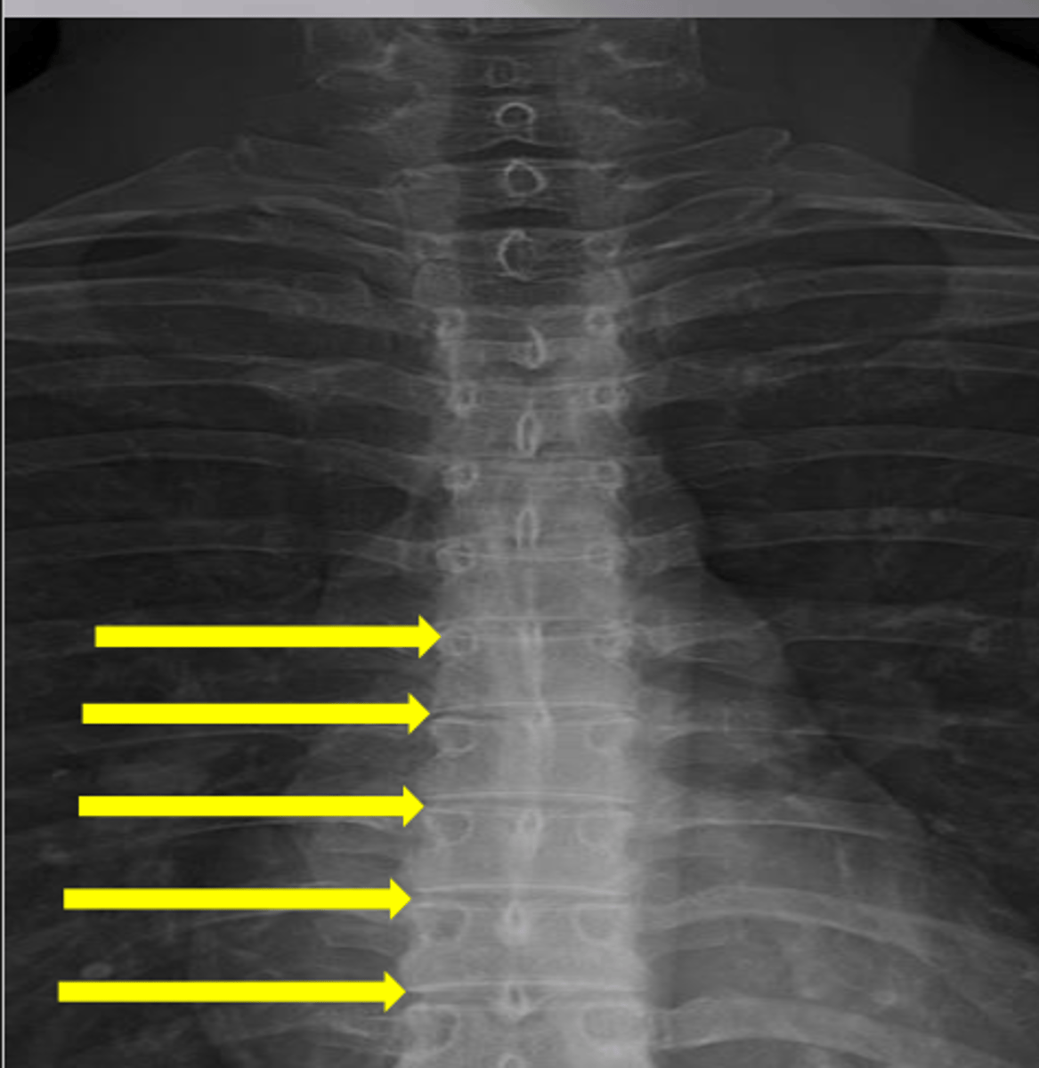 <p>What feature is shown here?</p>