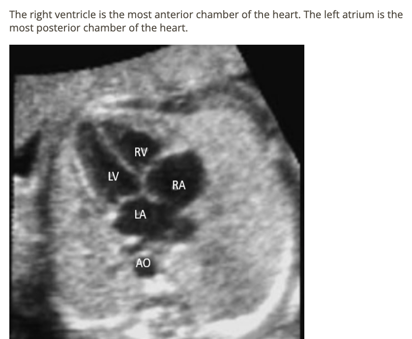 <p>c) right ventricle</p>