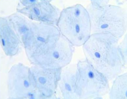 What is this a Microscopic image of? (Plant/Animal Cell)