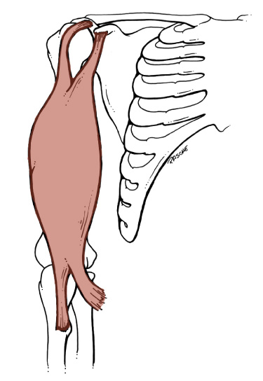 <p>Origin: <span>Short head: tip of the coracoid process of the Scapula; Long head: supraglenoid tubercle of the Scapula</span></p><p>Insertion: <span>Tuberosity of the Radius</span></p><p>Action: <span>flexes the forearm, flexes arm (long head), supinates</span></p>