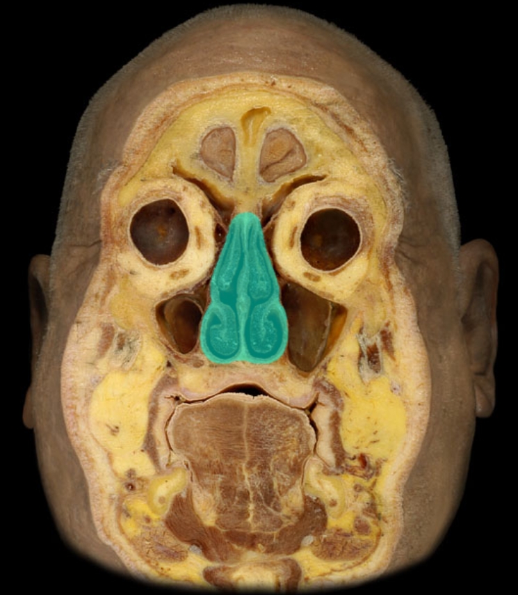 term image