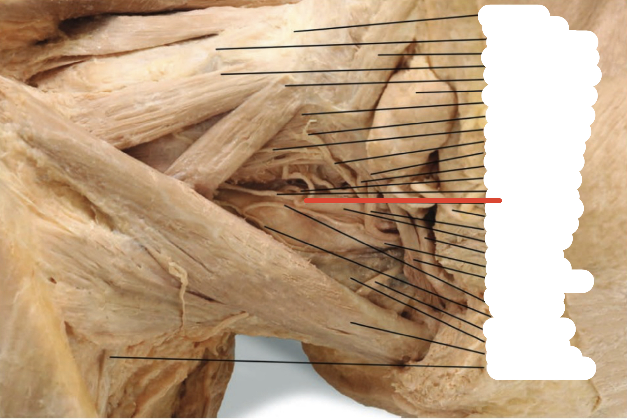 Identify the structure (red line)