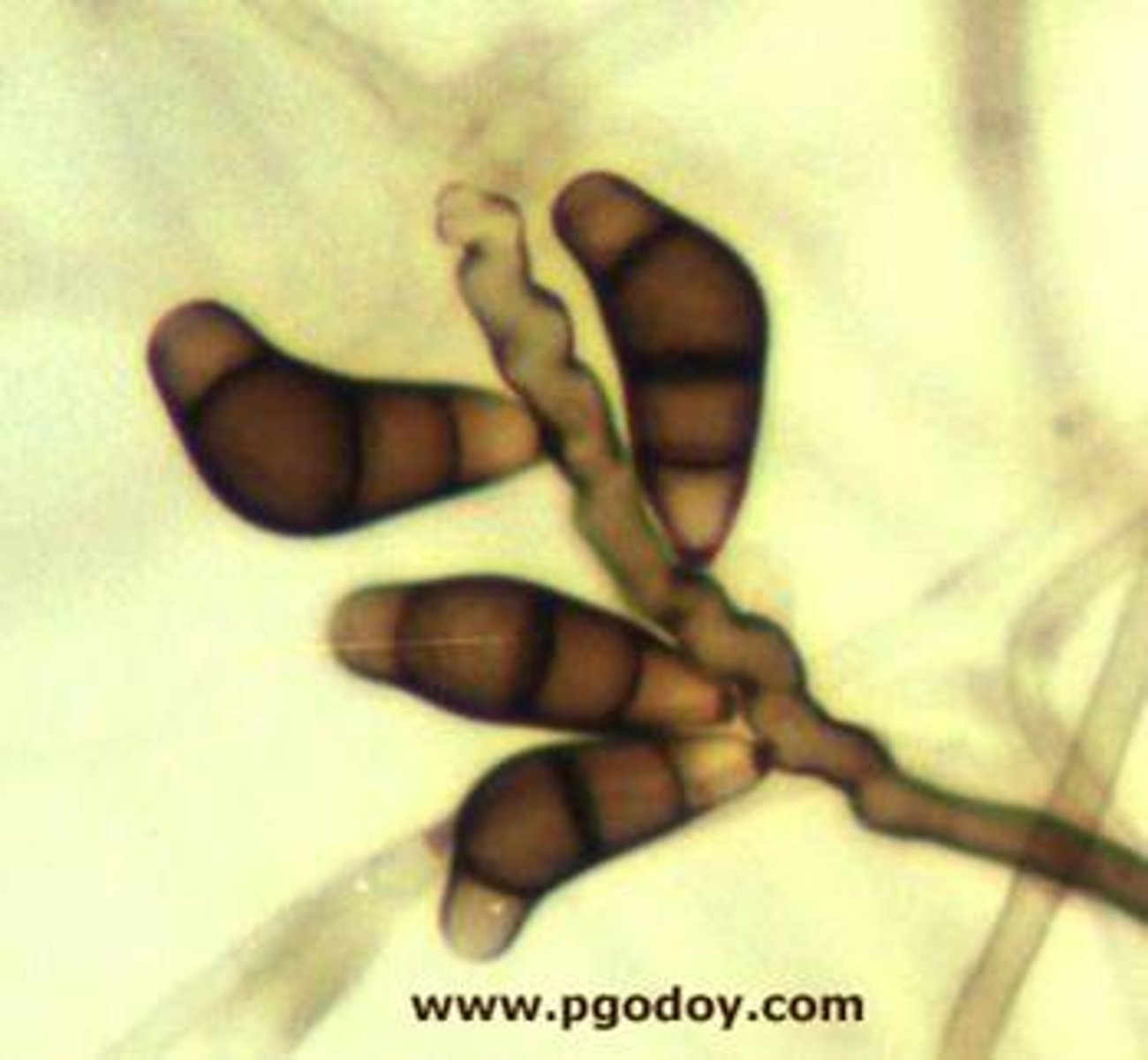 <p>Curvularia spp.</p>