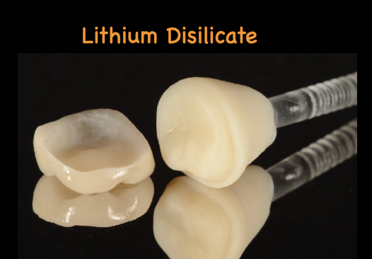 <p>Lithium Disilicate properties</p>