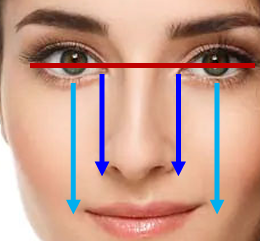 <p>Centered in orbit; inferior to supraorbital margin (red); medial canthi align with nasal wings (blue); vertical plane = mouth ends (celeste)</p>