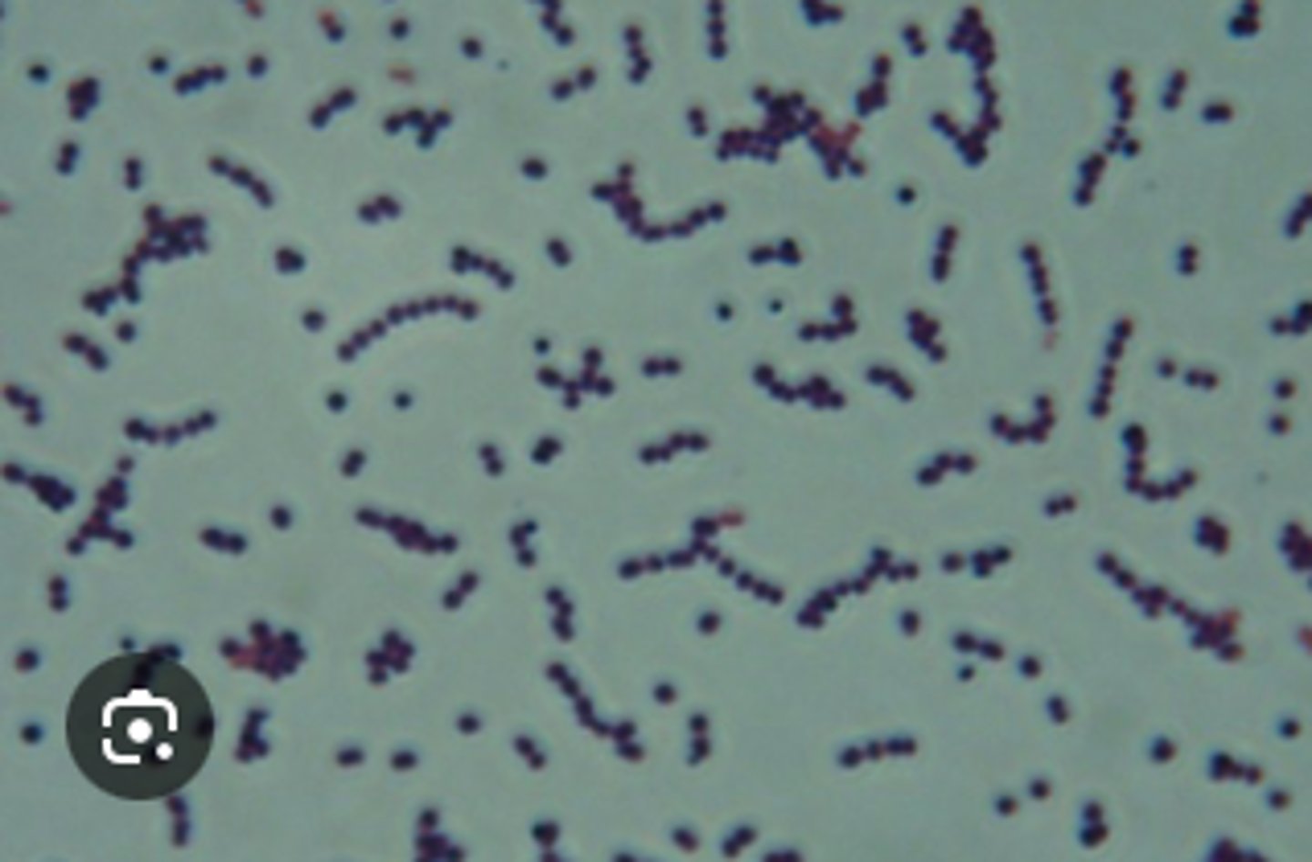 <p>A Quarter horse presents with fever and thick mucopurulent nasal discharge.</p><p>Tests:</p><p>BA has Beta-hemolysis (NO MAC)</p><p>See Cytology </p>