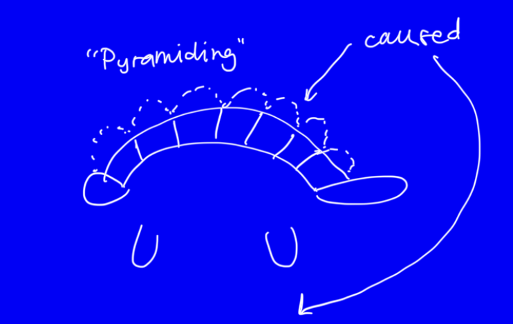 <ul><li><p>inverse ca: p </p></li><li><p>vitamin d3 deficicent</p></li><li><p>too much energy and protein </p></li><li><p>Galapagos tortoise </p></li></ul><p></p>