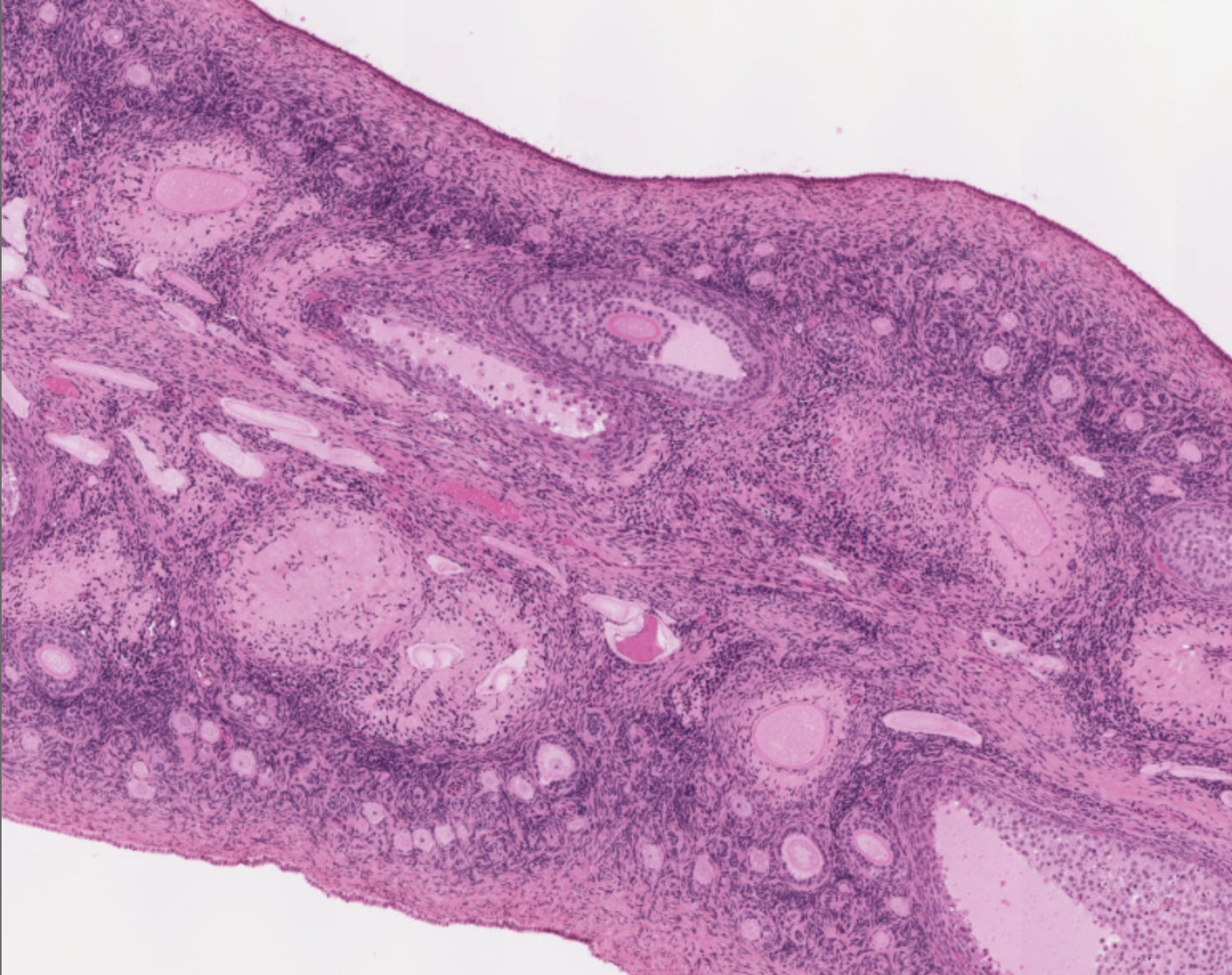 <p>How can you identify an ovary on a slide?</p>