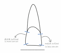 <p>nearly straight incisal edge, mesially straight and while distally rounded</p>