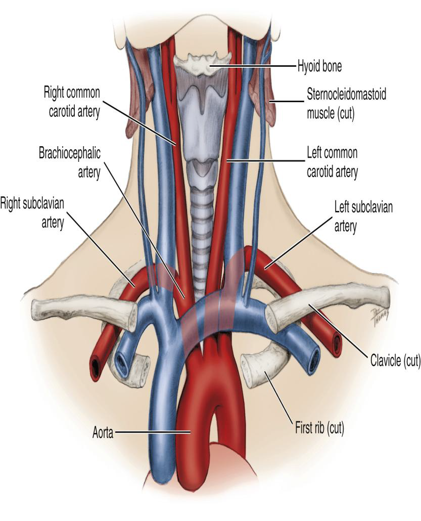 <p>Where does the Internal Carotid Artery travel after the bifurcation?</p>