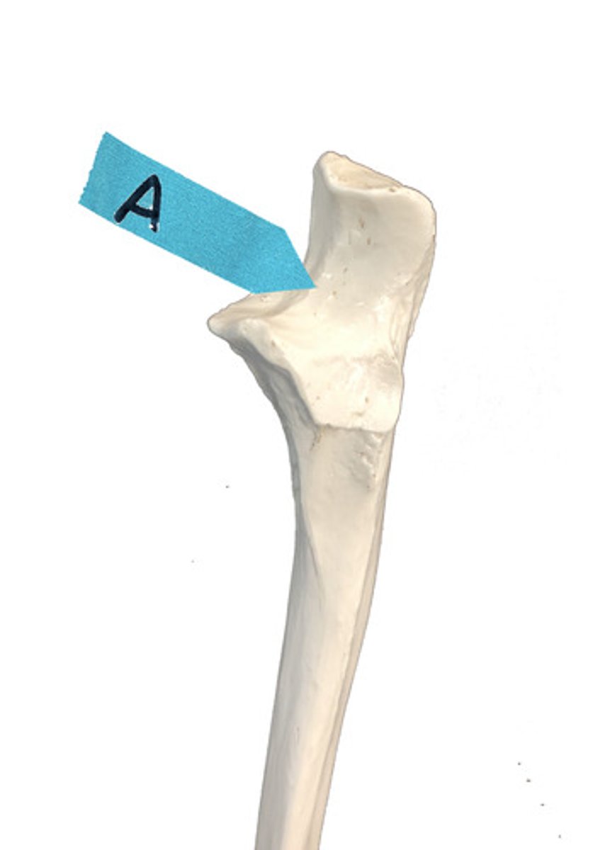 <p>Identify this bone marking</p>
