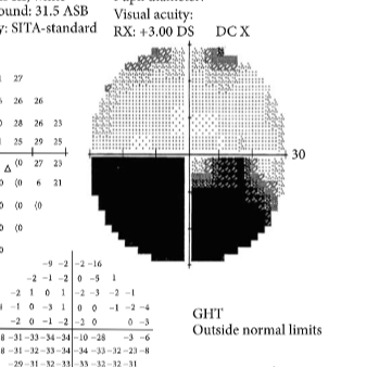 <p>What is this VF plot showing</p>