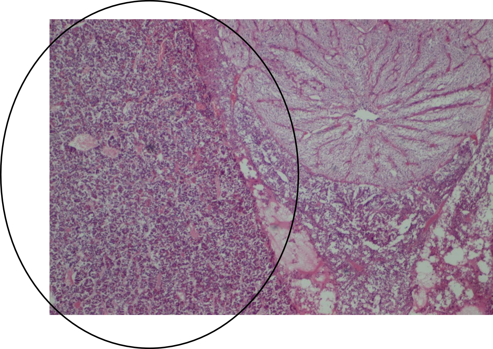 <p>Anterior Pituitary Gland (Adenohypophysis)</p>